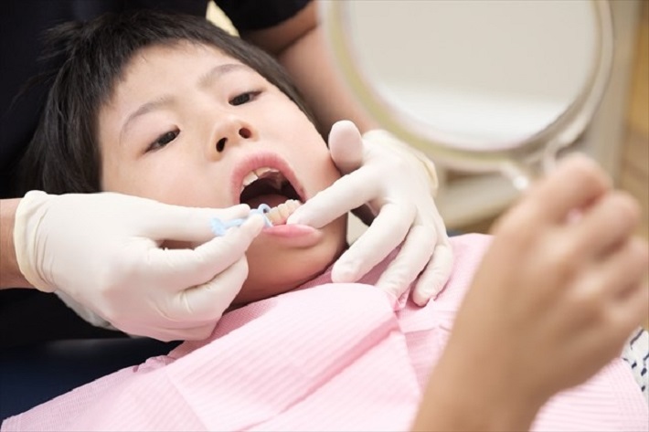 【教えてドクター】歯並びって遺伝する？　矯正治療前に予防する方法ってあるの？
