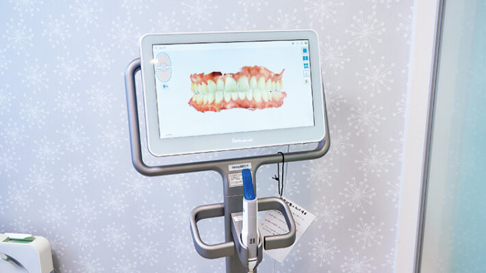 矯正治療後の歯並びのシミュレーションを見ることができる3Dスキャナーを導入。（はるまちざか歯科・矯正歯科 川崎市宮前区）